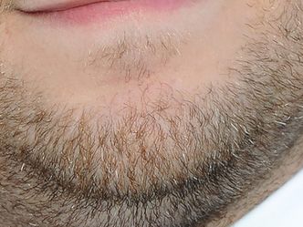 This one should be easy. Name the chin.