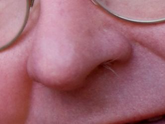 Guess the owner of this hair-infested nose.