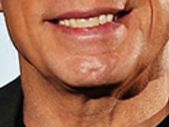 Whose chin is it?
