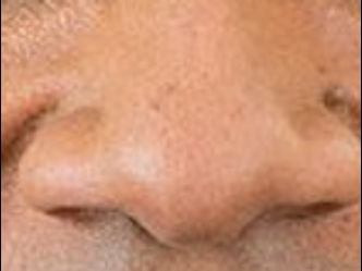 Can you recognize this nose?