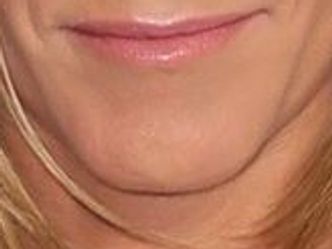 Can you recognize this chin?