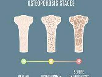 Which connective tissue is most likely to be affected by osteoporosis?
